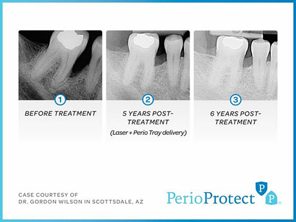 Ghina Morad, DMD | T-Scan, Dental Sealants and Oral Cancer Screening