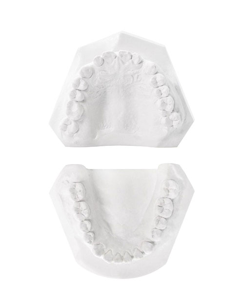 A pair of dental implants displayed against a plain background.