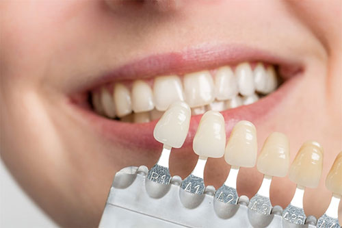 A woman smiling at the camera, holding a tray of dental implants with tooth-like attachments.