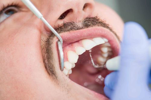 A person receiving dental care, with a visible dental implant being fitted and a dental professional s hand holding a tool near the mouth.