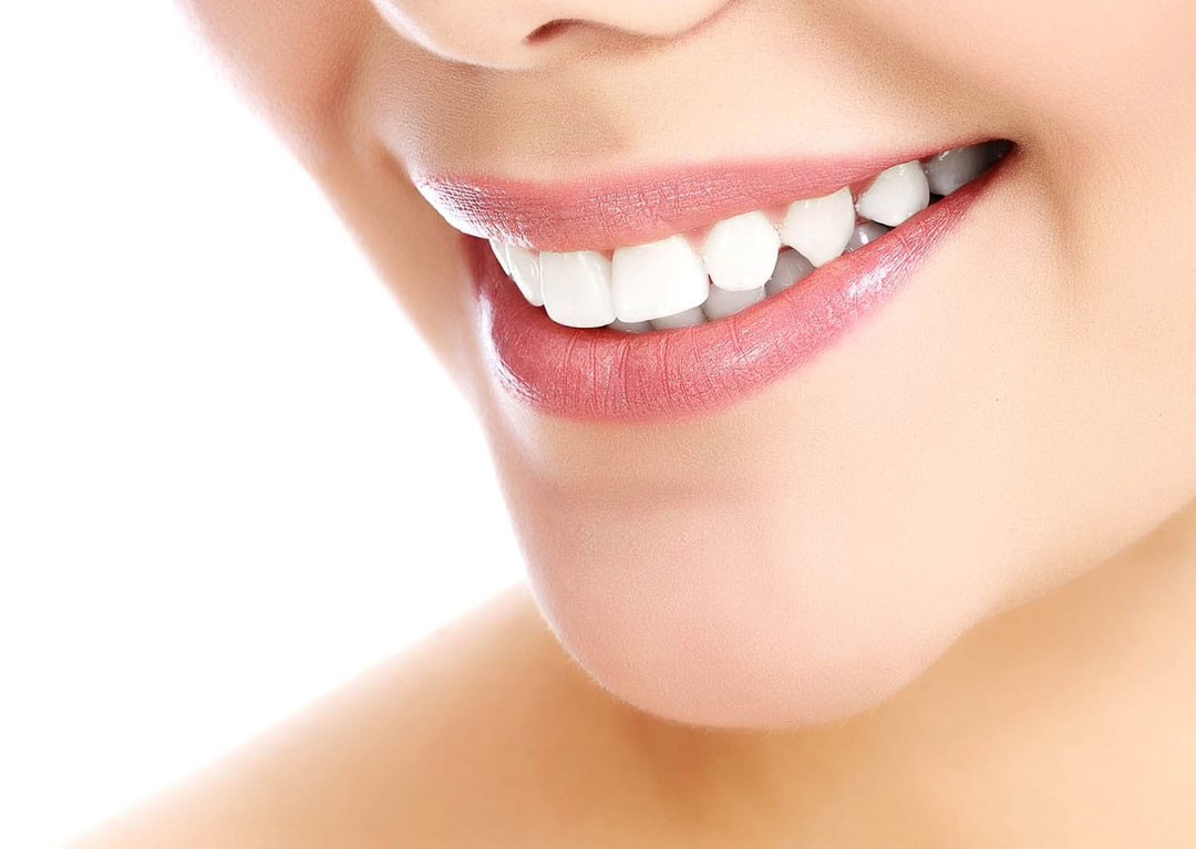 The image shows a close-up of a person s face with a bright smile, focusing on the teeth and lips.