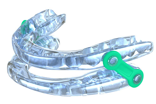 The image shows a clear plastic dental appliance with multiple teeth-like protrusions, positioned in an open position and laid out on a surface.